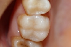 bb0a60e9ba955deb