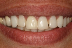 48389d20065ed26c