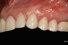 d586b86860ac5919