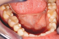 39f25e0122c8922f