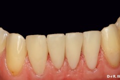 0990a14ad74db8c7