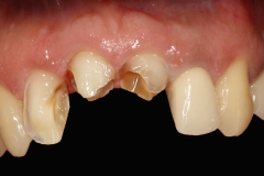 90d29a08d7064230