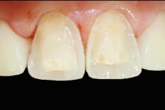 00db522c81826934