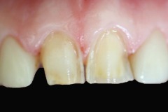 96d4054de33c4deb