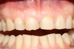 70935d01d92d9145
