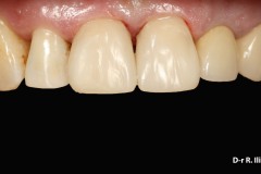 eb75dff3460211a1